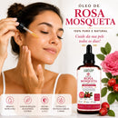 Óleo de Rosa Mosqueta 100% Puro e Natural 50ml Prensado a Frio | Rosa rubiginosa | Canteiro de Ervas